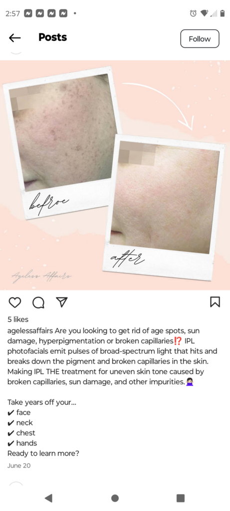 Med Spa Social Media Before and After Instagram